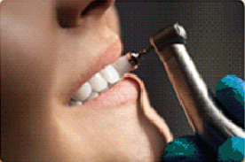 Preenchimento labial